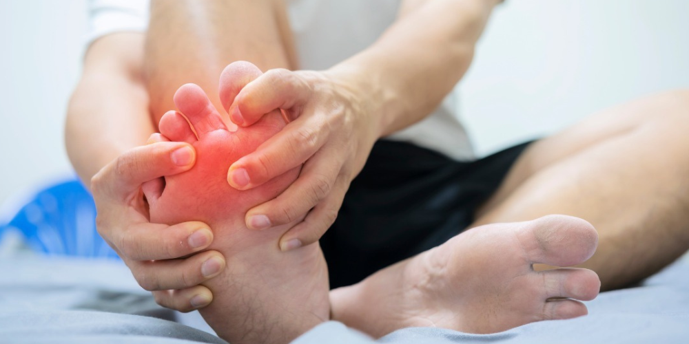 New Study Uncovers Gout Myths